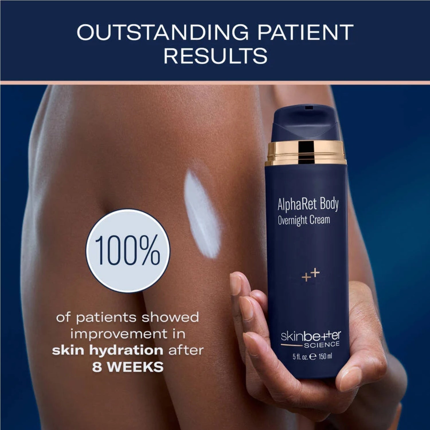 Skinbetter AlphaRet crema corpo notte 150 ml rassodante
