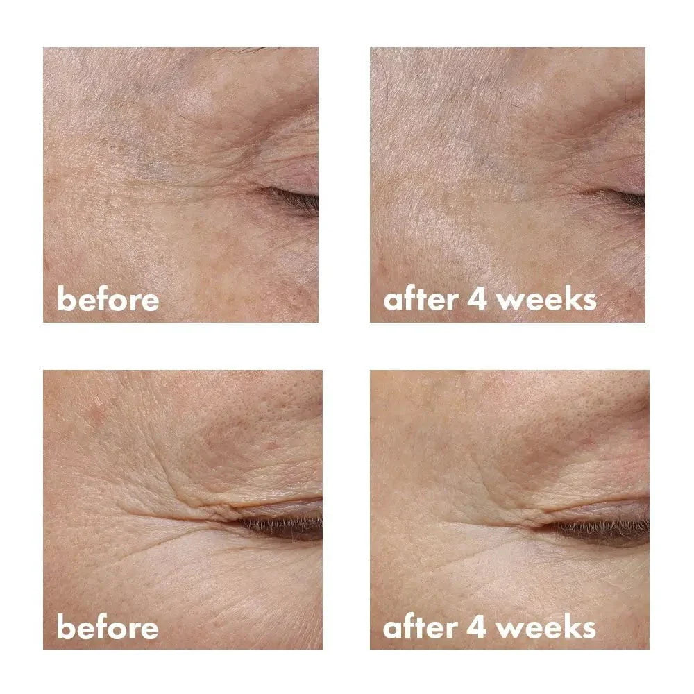 Whish Revitalizing crema contorno occhi bakuchiol 15 ml